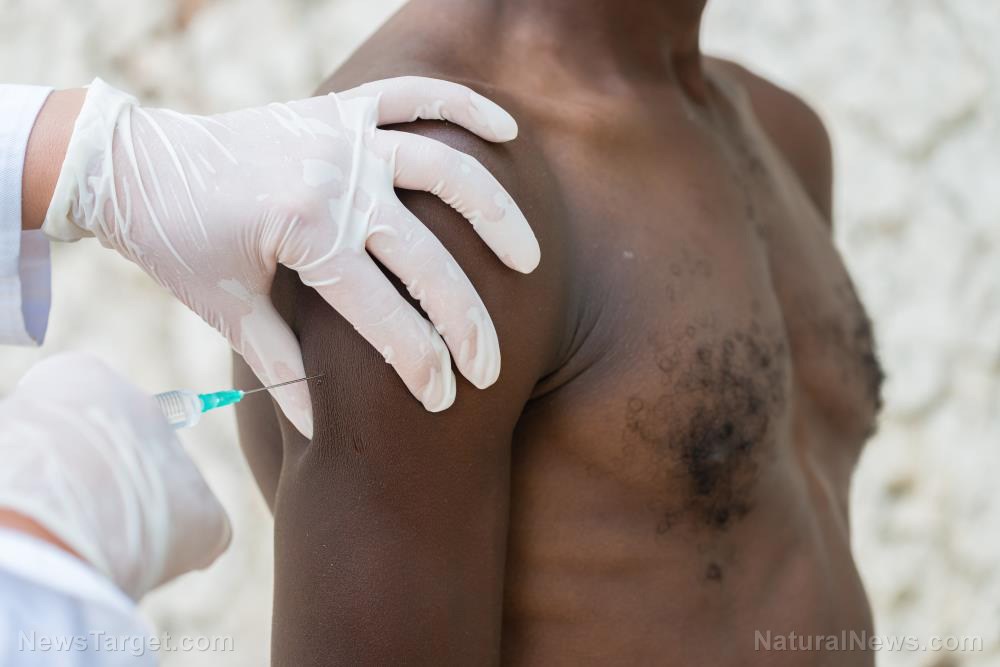 In Afrika sind nur 6 % der Bevölkerung geimpft, und das Covid ist praktisch verschwunden… Wissenschaftler sind verblüfft.